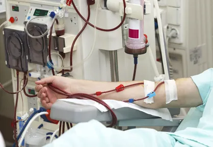 دیالیز با کمک فناوری نانو سریع&zwnj;تر انجام خواهد شد
