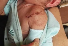 کودک آزاری به سبک گازگرفتن +عکس