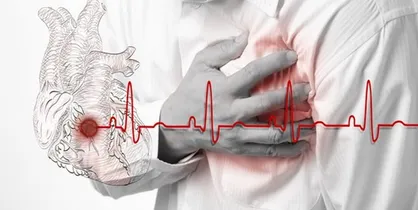 مشکلی در زمینه تجهیزات درمانی قلب و عروق نداریم
