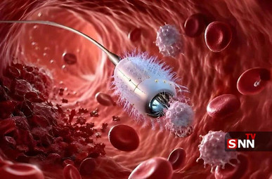 شکار سلول‌های سرطانی با ربات مویی شکل