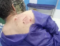 خرس به یک جوان کشاورز جیرفتی حمله کرد