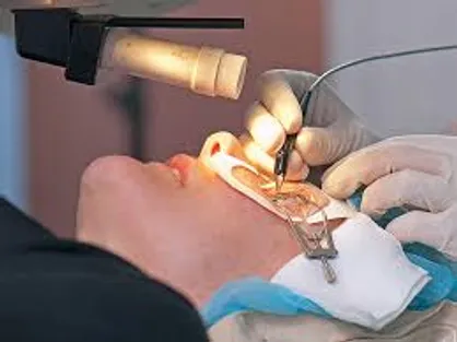 شرایط عمل لیزر برای‬ افراد‬ عینکی / حدود &rlm;۲۵ تا ۵۰ درصد جامعه عینک نیاز دارند