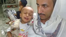 ۳ هزار کودک سرطانی یمن، در معرض خطر مرگ قرار دارند