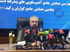 طباییان: کبد چرب به شایع‌ترین علت پیوند کبد تبدیل شده است