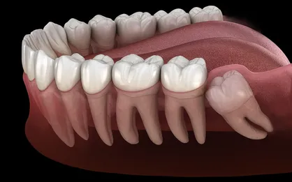 ماجرای واردات یونیت&zwnj;های دندانپزشکی با وجود تولید داخل چه بود؟