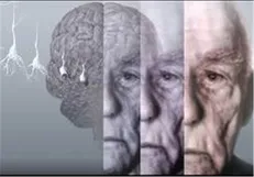 چربی‌های ترانسی که باعث ابتلا به«آلزایمر» می‌شود