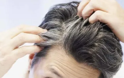 استرس باعث خاکستری شدن مو می&zwnj;شود