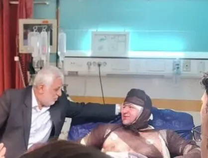 استاندار لرستان از جوان حافظ طبیعت در حادثه آتش&zwnj;سوزی خرم&zwnj;آباد عیادت کرد