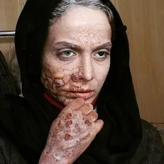 چرا مهناز افشار باید دادگاهی شود؟