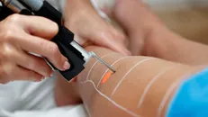 شرکت دانش بنیان البرزی موفق به طراحی و تولید لیزرهای پزشکی، دندانپزشکی، دامپزشکی و کشاورزی شد