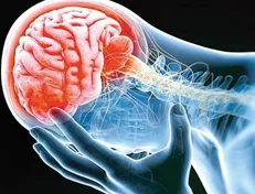 تشنج علامت اصلی عفونت شدید کووید ۱۹ در کودکان است