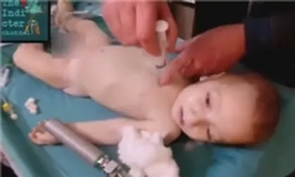 سازمان ملل، دمشق را به استفاده از سلاح شیمیایی متهم کرد