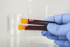 تلاش ترکیه برای دستیابی به قطرات خون یا DNA خاشقجی