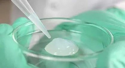ترمیم عضو آسیب&zwnj;دیده بدون عمل جراحی با هیدروژل