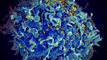 جنگ&zwnj;افزار جدید برای مقابله با HIV ساخته شد