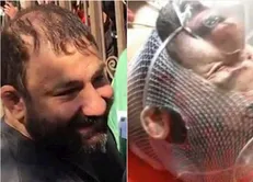 آخرین وضعیت جسمی «هانی کُرده» از اراذل و اوباش تهران