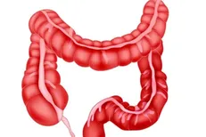 بهبود سلامت روده موجب افزایش طول عمر می شود