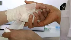 اسپری ضدباکتری آسیب‌های پوستی را درمان می‌کند