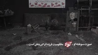 صورت سوخته او، گواه مظلومیت فرزندان این وطن است