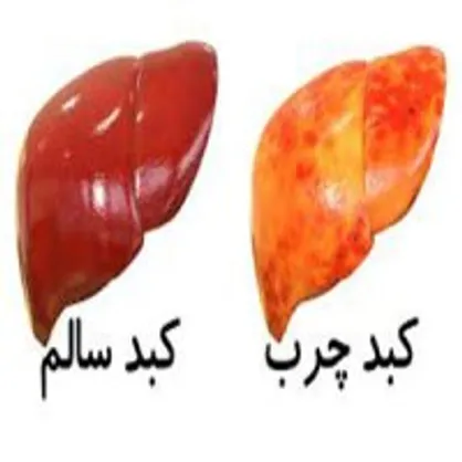 با این میوه&zwnj;ها کبد چرب را درمان کنید