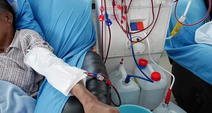 امکان ساخت عروق مصنوعی از سلول&zwnj;های بیماران دیالیزی وجود دارد