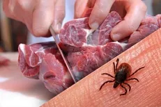 چند نکته بهداشتی برای اینکه به تب کریمه کنگو مبتلا نشویم