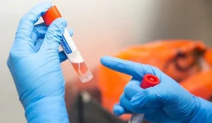 بررسی وضعیت ۱۴ میلیون نفر در طرح بسیج ملی مقابله با کرونا