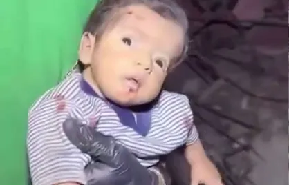 شوک و حیرت در چشمان نوزاد فلسطینیِ نجات&zwnj;یافته از زیر آوار خانه ویران&zwnj;شده