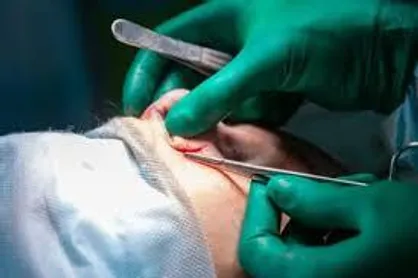 افزایش تقاضا برای جراحی زیبایی صورت