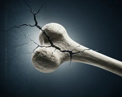 چرا با افزایش سن، سلامت استخوان&zwnj;ها تهدید می&zwnj;شود؟
