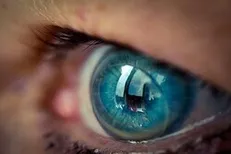 تشکیل پرونده قضایی برای فروشنده لنز‌های تقلبی