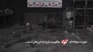 صورت سوخته او، گواه مظلومیت فرزندان این وطن است