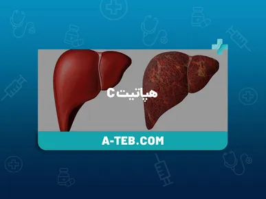 شناسایی ۷۰۷ مبتلای فعال به هپاتیت C در شیراز / ۶۳۵ بیمار وارد چرخه درمان شدند