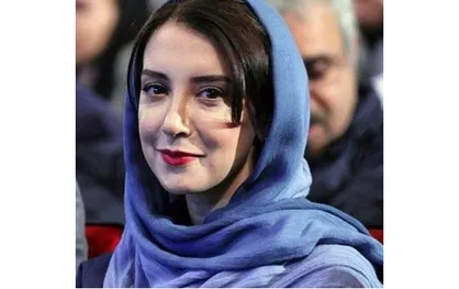 معلولیت فَک &laquo;سحر جعفری جوزانی&raquo; بر اثر خطای پزشکی! + فیلم