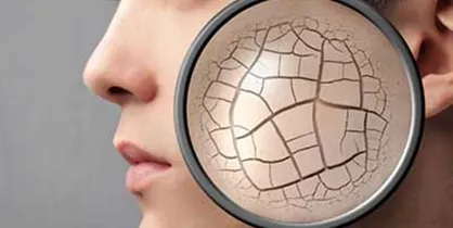 محققان تبریزی ژلی برای بهبود چین و چروک پوست تولید کردند