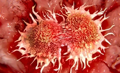 تشخیص سریع پیشرفت سرطان با کمک MRI امکان پذیر شد / از ساخت قلم رسانای آموزشی تا کاهش عوارض جانبی دارو&zwnj;ها با نانوکپسول&zwnj;ها