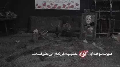 صورت سوخته او، گواه مظلومیت فرزندان این وطن است
