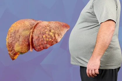 مرگ خاموش