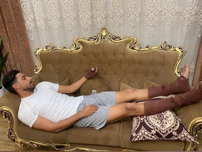 نجات جان همسایه با سوختگی بازیکن داماش همراه شد