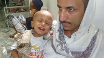 ۳ هزار کودک سرطانی یمن، در معرض خطر مرگ قرار دارند