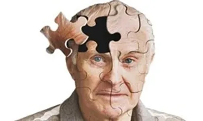 تشخیص به موقع آلزایمر از طریق فناوری ایرانی