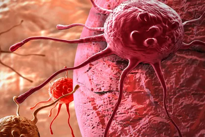 تشخیص زودهنگام سرطان تخمدان تنها از طریق نمونه خون ممکن شد