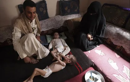 سعودی&zwnj;ها از گرسنگی در یمن به عنوان ابزار چانه&zwnj;زنی استفاده می&zwnj;کنند