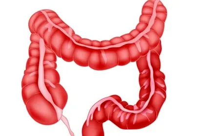 بهبود سلامت روده موجب افزایش طول عمر می شود