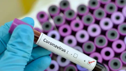 اینفوگرافیک اقدامات پیشگیرانه دانشگاه گلستان برای مقابله با کرونا منتشر شد