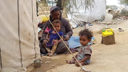 کودکان سرطانی یمن چشم انتظار بازگشایی فرودگاه صنعا