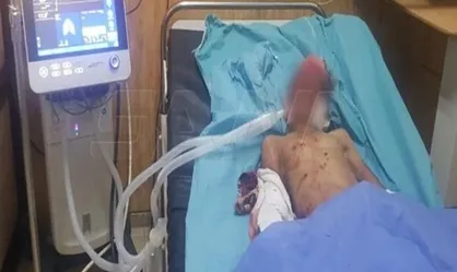 انفجار در سوریه به کشته شدن ۲ غیرنظامی و زخمی شدن ۶ کودک منجر شد