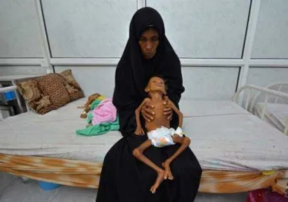 محاصره یمن همچنان پا برجاست
