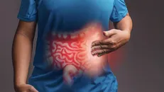 التهاب روده، خطر پوکی استخوان را افزایش می‌دهد/حذف خودسرانه لبنیات سلامت بیماران گوارشی را تهدید می‌کند