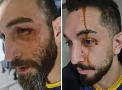 بزن بزن و کتک&zwnj;کاری در لیگ برتر +عکس